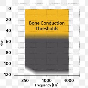 Hearing Aids - Bone-anchored Hearing Aid Cochlear Implant Bone Conduction Cochlear Bone Anchored Solutions Hearing Loss PNG