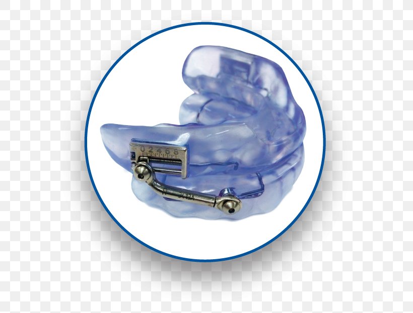 Mandibular Advancement Splint Obstructive Sleep Apnea Dentistry, PNG, 600x623px, Mandibular Advancement Splint, Continuous Positive Airway Pressure, Dentist, Dentistry, Insomnia Download Free