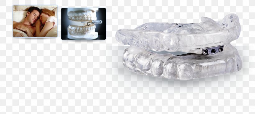 Snoring Dentistry Mandibular Advancement Splint Mouthguard, PNG, 1000x448px, Snoring, Apnea, Body Jewelry, Cosmetic Dentistry, Dental Laboratory Download Free