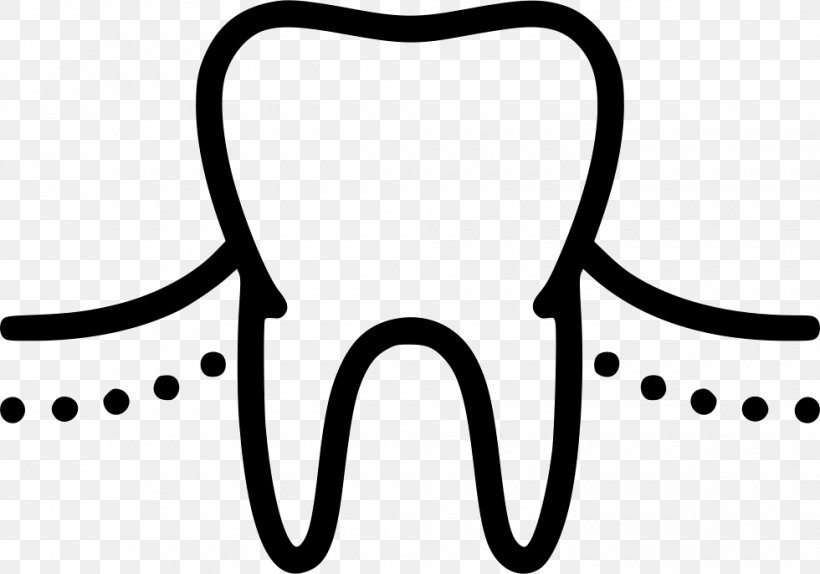 Dentistry Tooth Medicine Mucogingival Junction Physician, PNG, 980x686px, Dentistry, Black, Black And White, Body Jewelry, Gums Download Free