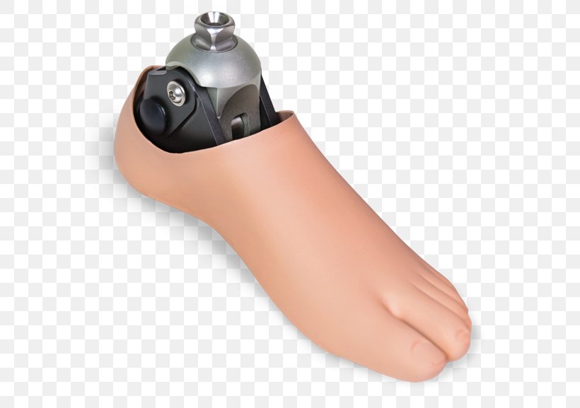 Prosthesis Foot College Fußprothese, PNG, 600x577px, Prosthesis, College, Dental Technician, Dynamics, Empresa Download Free