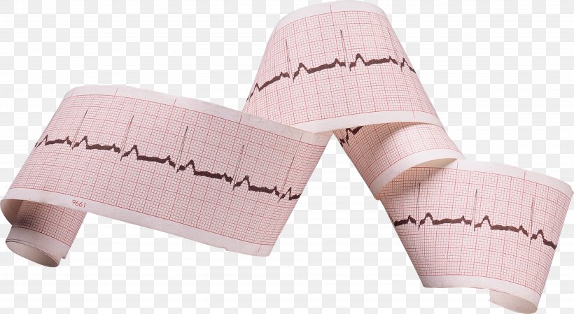 Heart Arrhythmia Left Ventricle Human Heart, PNG, 3674x2015px, Heart, Cell, Disease, Electrocardiography, Heart Arrhythmia Download Free