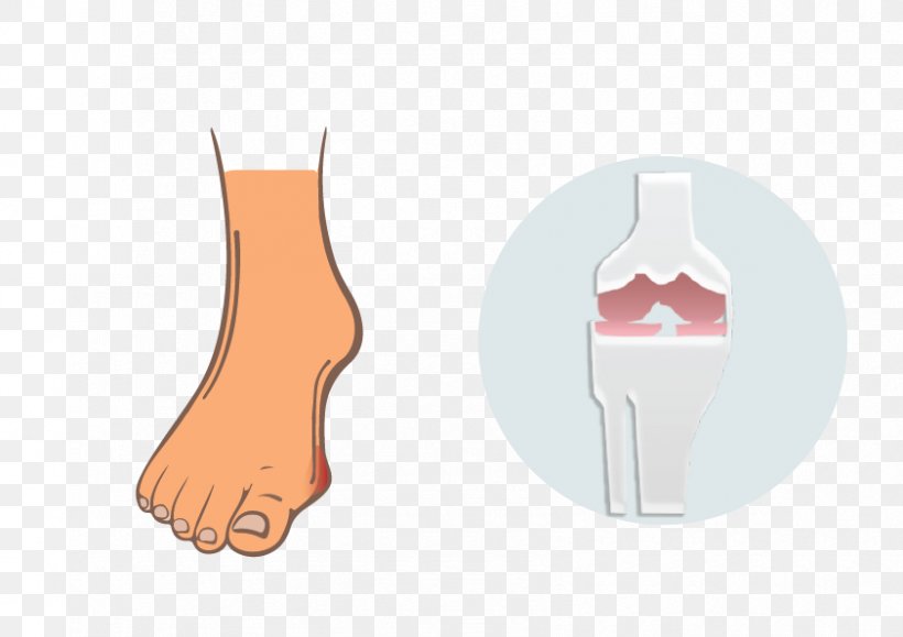 Thumb Hand Model Finger Human Leg, PNG, 842x595px, Thumb, Ankle, Finger, Foot, Footwear Download Free
