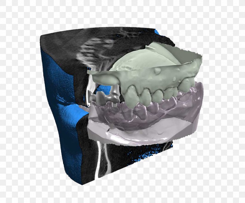 CAD/CAM Dentistry DICOM Computer Software Abutment Computer-aided Design, PNG, 1061x878px, Cadcam Dentistry, Abutment, Basis, Cadstar, Computed Tomography Download Free
