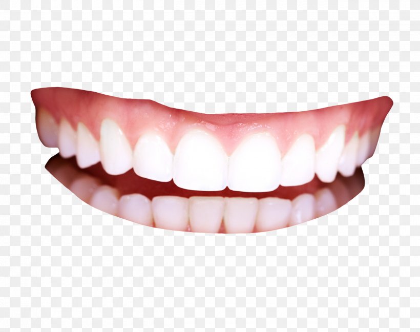 Human Tooth, PNG, 2500x1976px, Tooth, Cosmetic Dentistry, Dentist, Dentistry, Dentures Download Free