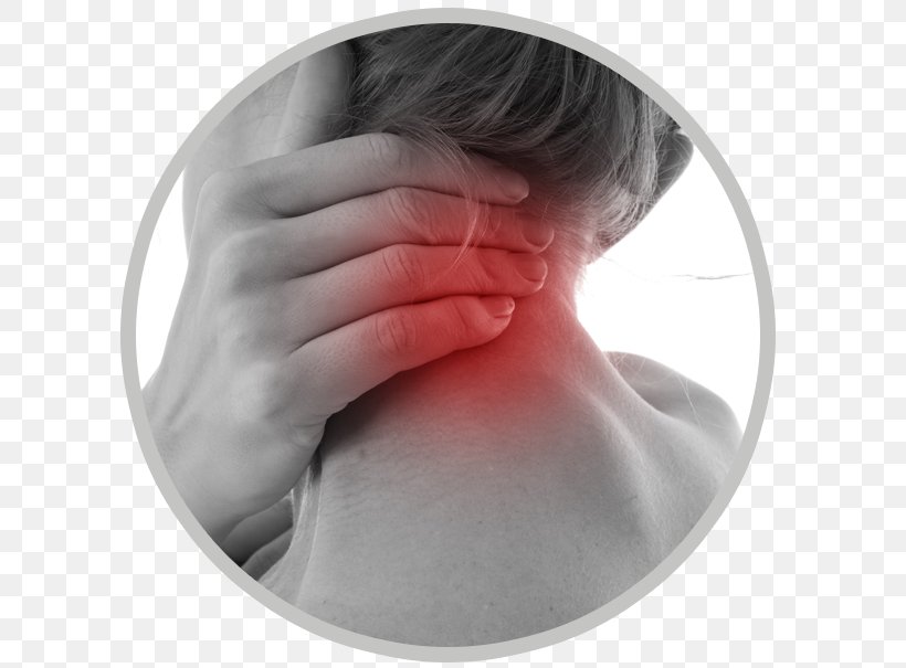 Neck Pain Neck And Shoulder Pain Smesman / Jeroen Headache, PNG, 605x605px, Neck Pain, Chin, Chiropractic, Face, Forehead Download Free