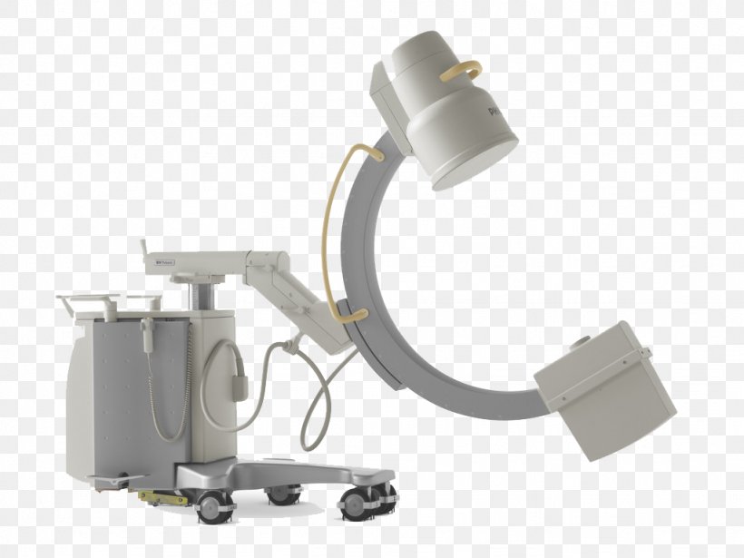Abdominal Aortic Aneurysm Bracelet Medical Imaging X-ray Image Intensifier, PNG, 1024x768px, Abdominal Aortic Aneurysm, Aneurysm, Aorta, Aortic Aneurysm, Bracelet Download Free