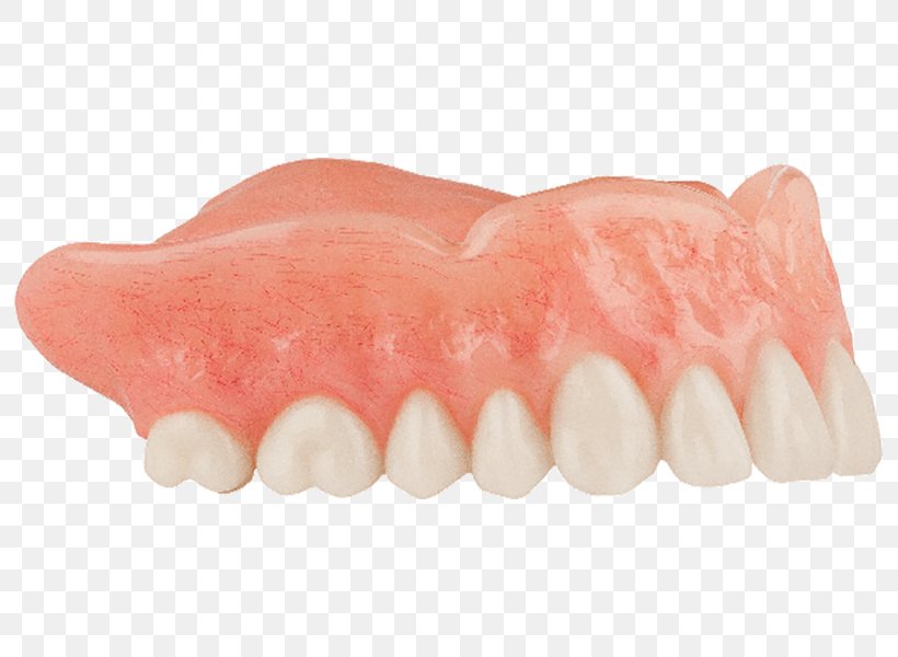 Human Tooth Dentures, PNG, 800x600px, Tooth, Dentures, Human Tooth, Jaw, Lip Download Free