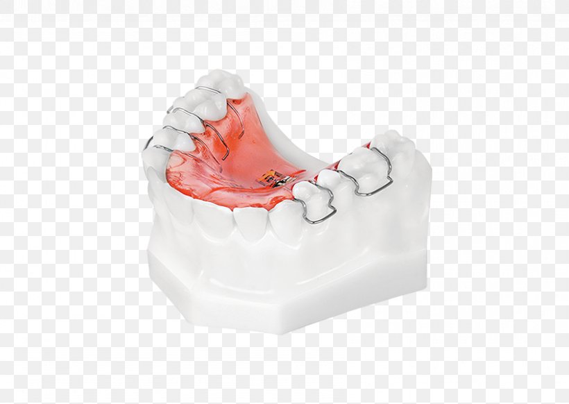 Tooth Health, PNG, 845x600px, Tooth, Beautym, Health, Jaw Download Free