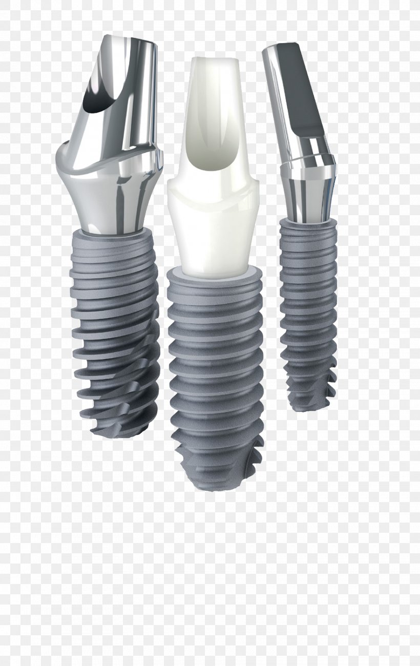 Implantology Dental-Club Dentistry Anthogyr SAS, PNG, 1763x2797px, Implant, Anthogyr Sas, Auto Part, Automotive Engine Part, Dental Implant Download Free