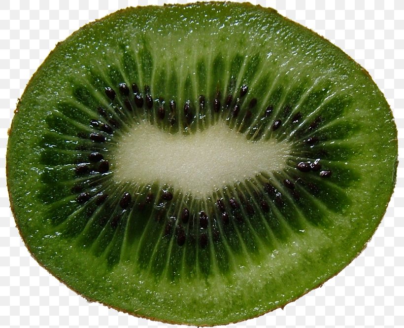 Kiwifruit Clip Art Food, PNG, 800x665px, Kiwifruit, Actinidia, Berry, Food, Fruit Download Free