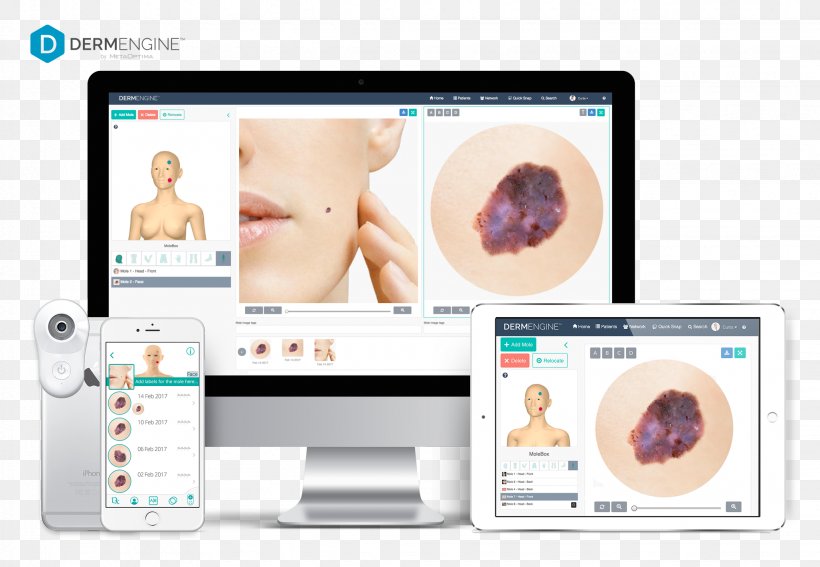 Skin Cancer Teledermatology Dermatoscopy MetaOptima Technology Inc., PNG, 2055x1422px, Skin Cancer, Dermatology, Dermatoscopy, Education, Electronics Download Free