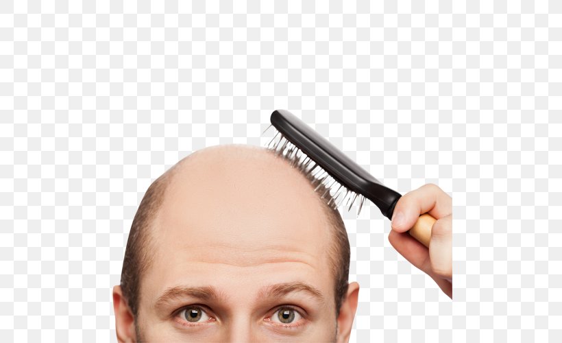 Hair Loss Health Hair Care Scalp, PNG, 500x500px, Hair Loss, Capelli, Cheek, Chin, Dandruff Download Free