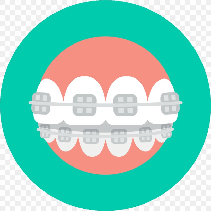 Dental Braces Dentistry Orthodontics Dental Implant, PNG, 1068x1068px, Dental Braces, Clear Aligners, Crown, Dental Implant, Dental Restoration Download Free