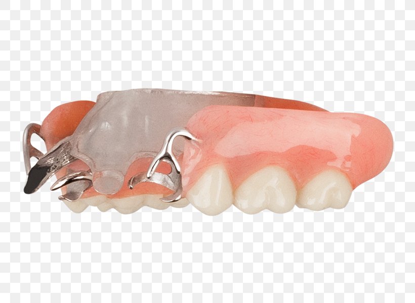 Dentistry Tooth Dentures Aspen Dental Evansville, PNG, 749x600px, Dentistry, Alcoa, Aspen Dental, Dentures, Evansville Download Free