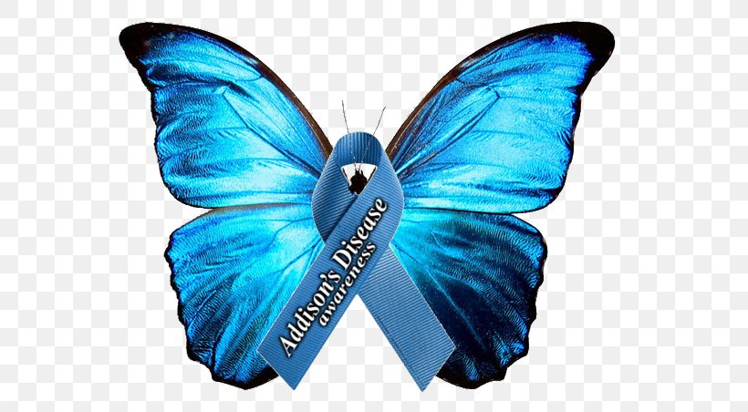 Addison's Disease Adrenal Insufficiency Adrenal Crisis Awareness Ribbon, PNG, 612x452px, Adrenal Insufficiency, Adrenal Crisis, Adrenal Fatigue, Adrenal Gland, Aldosterone Download Free