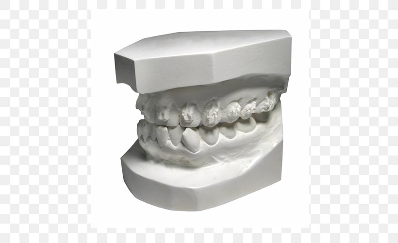 Dentistry Human Tooth, PNG, 600x500px, Dentistry, Human Tooth, Jaw, Tooth Download Free