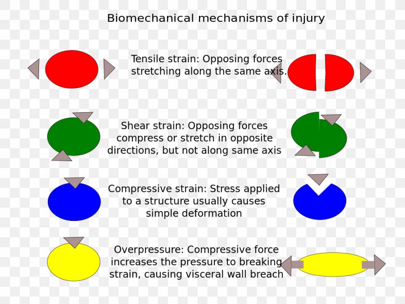 Sports Injury Biomechanics Organism, PNG, 1152x864px, Injury, Area, Biomechanics, Brand, Compression Download Free