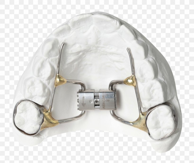 Orthodontics Orthodontic Technology Clothing Accessories Silver, PNG, 1024x863px, Orthodontics, Clothing Accessories, Fashion, Fashion Accessory, Home Appliance Download Free