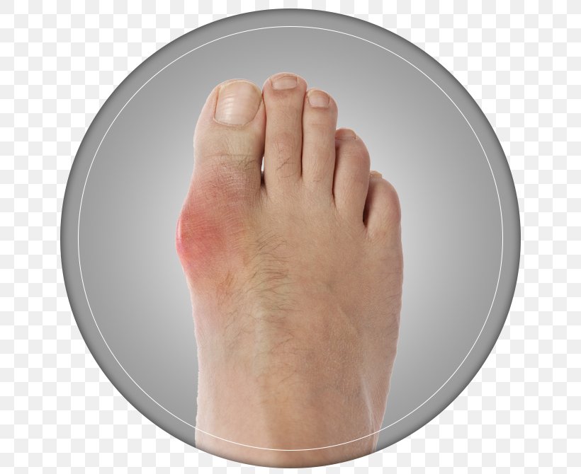 Thumb Bunion Toe Hallux Shoe Size, PNG, 670x670px, Watercolor, Cartoon, Flower, Frame, Heart Download Free