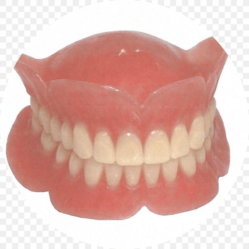 Dentures Dentistry Removable Partial Denture Dental Implant, PNG, 1024x1024px, Dentures, Bridge, Cosmetic Dentistry, Dental Implant, Dental Laboratory Download Free