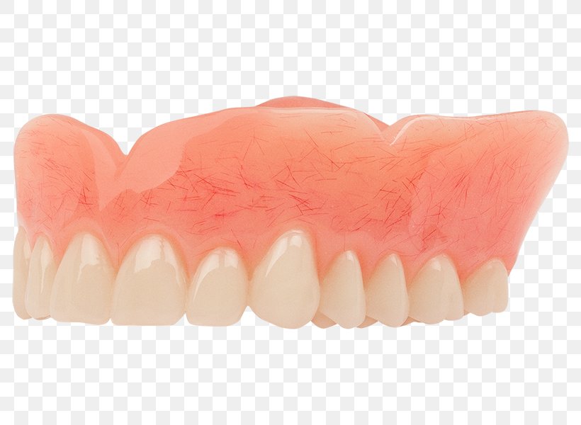 Tooth Dentistry Dentures Aspen Dental, PNG, 800x600px, Tooth, Aspen Dental, Cincinnati, Columbia, Dentist Download Free