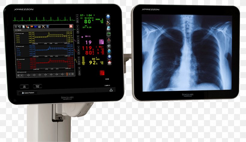 Display Device Monitoring Medicine Patient Cardiology, PNG, 1557x900px, Display Device, Anaesthetic Machine, Anesthesia, Cardiac Monitoring, Cardiology Download Free