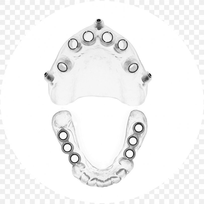 Dental Implant Surgery Dentistry Axi Dental Lab, PNG, 2044x2044px, Dental Implant, Auto Part, Axi Dental Lab, Biocompatibility, Black And White Download Free