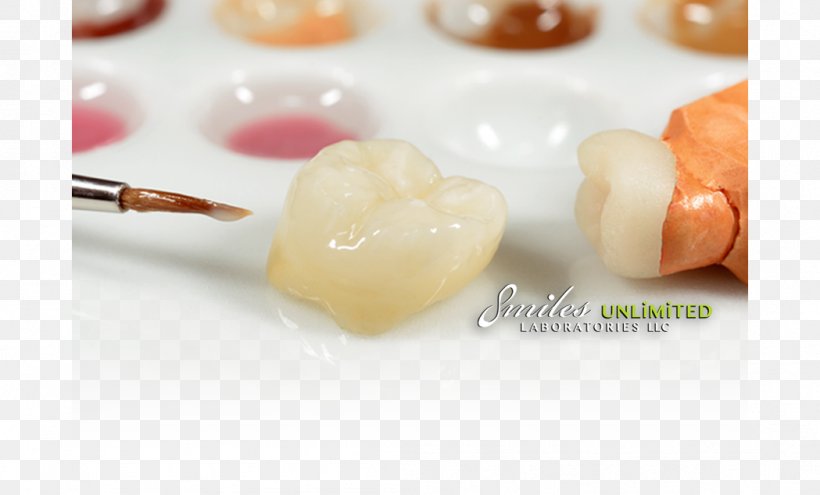 Crown Dentistry Dental Laboratory Dental Technician, PNG, 1049x634px, Crown, Cosmetic Dentistry, Dental Laboratory, Dental Prosthesis, Dental Surgery Download Free