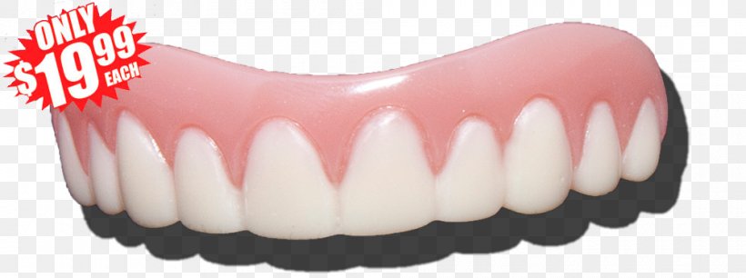 Human Tooth Dentures Veneer Wisdom Tooth, PNG, 1000x374px, Watercolor, Cartoon, Flower, Frame, Heart Download Free