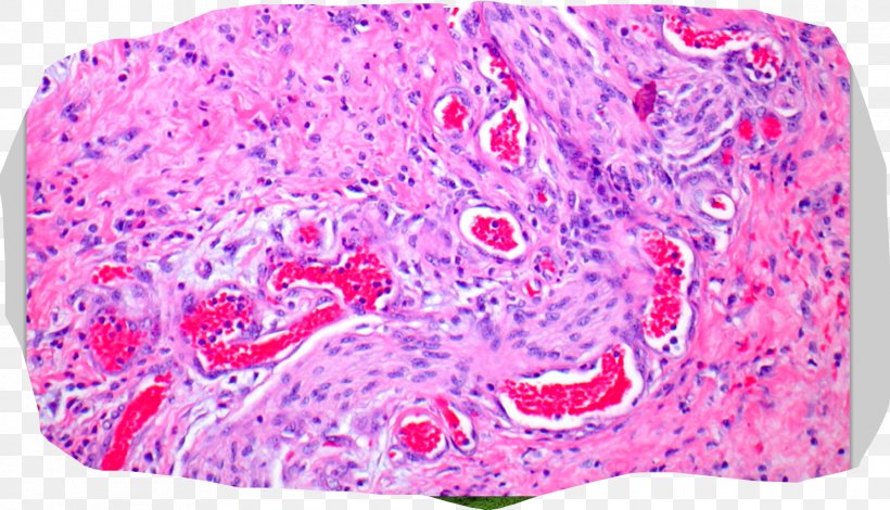 Columbia College Organism Histology Pathology Flashcard, PNG, 2076x1192px, Columbia College, College, Columbia, Flashcard, Gastrointestinal Tract Download Free