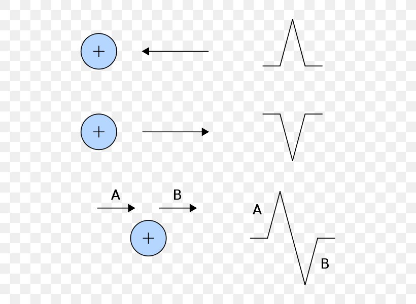 Electrocardiography Electrode Heart Einthoven's Triangle, PNG, 600x600px, Electrocardiography, Area, Cardiac Muscle, Curve, Depolarization Download Free