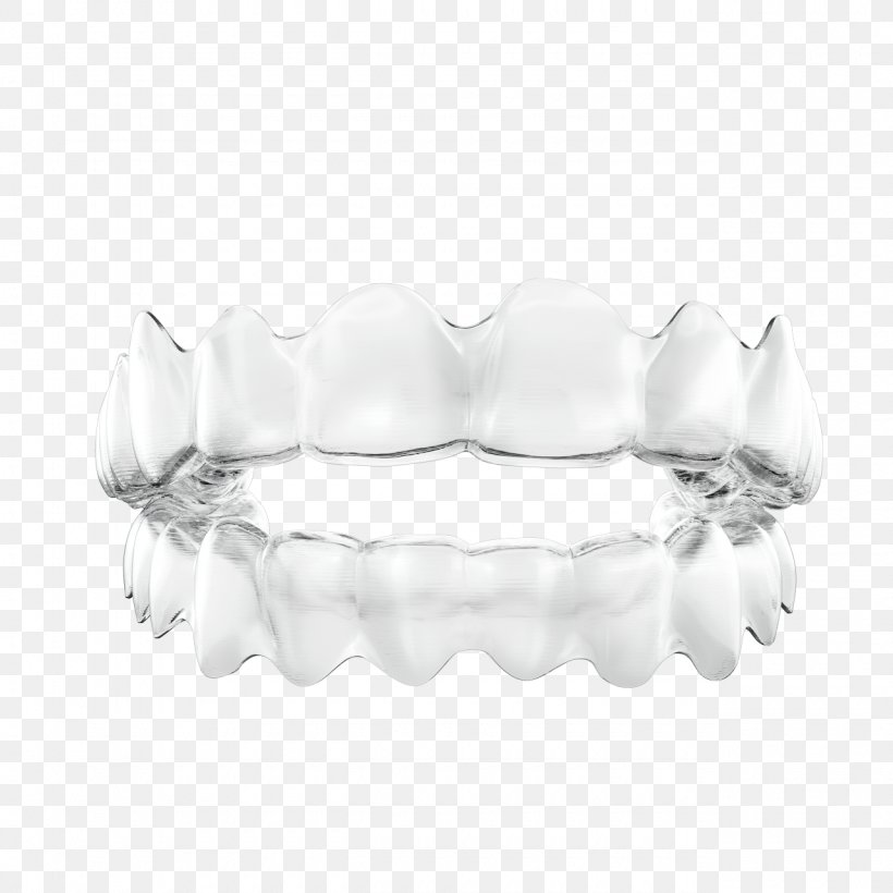 Clear Aligners Orthodontics Dental Braces Tooth Dentistry, PNG, 1280x1280px, Clear Aligners, Academy Of General Dentistry, Body Jewelry, Bracelet, Dental Braces Download Free