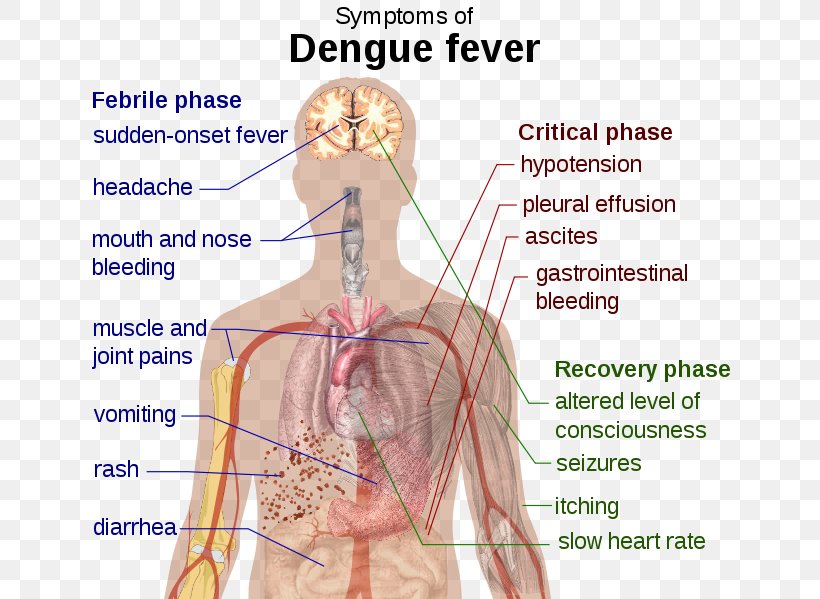 Dengue Symptomatic Treatment Fever Disease, PNG, 663x599px, Watercolor, Cartoon, Flower, Frame, Heart Download Free