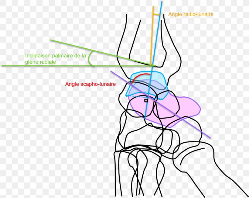 Angle Distal Radius Fracture Wrist Ulna, PNG, 1059x842px, Watercolor, Cartoon, Flower, Frame, Heart Download Free