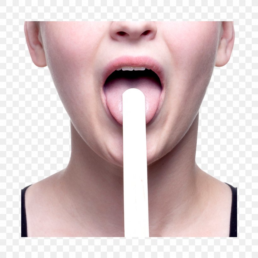 Tongue Depressor Sterilization Medicine Soft Palate, PNG, 1000x1000px, Tongue Depressor, Cheek, Chin, Cotton Buds, Face Download Free