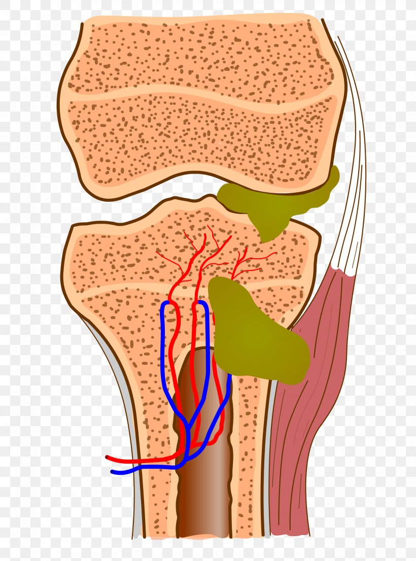 Osteomyelitis Blood Vessel Infection Bone Disease, PNG, 2778x3750px, Watercolor, Cartoon, Flower, Frame, Heart Download Free