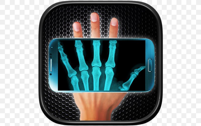 X-ray Scanner Simulator X-ray Scanner Prank Backscatter X-ray Xray Scanner Prank, PNG, 512x512px, Xray Scanner Prank, Android, Aptoide, Backscatter Xray, Computer Software Download Free