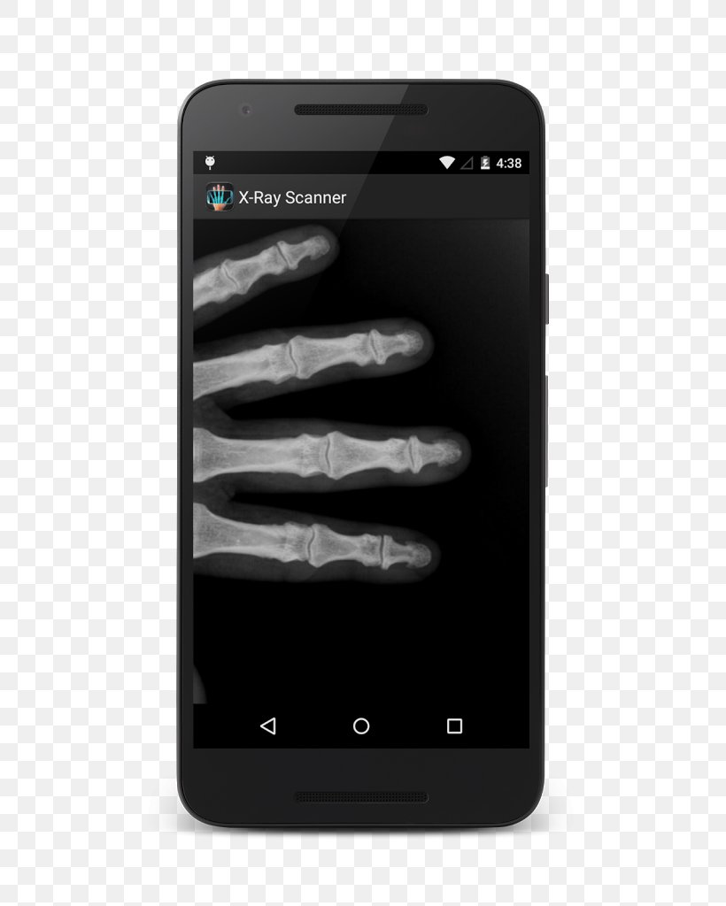 Smartphone Feature Phone X-ray Scanner Prank Android, PNG, 597x1024px, Smartphone, Android, Android Jelly Bean, Black And White, Camera Download Free
