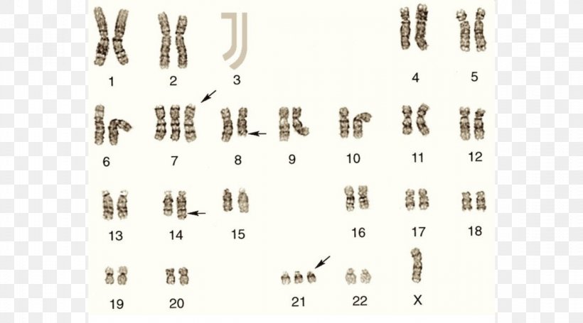 Trisomy Karyotype Nondisjunction Chromosome 21 Amyotrophic Lateral Sclerosis, PNG, 1146x637px, Watercolor, Cartoon, Flower, Frame, Heart Download Free