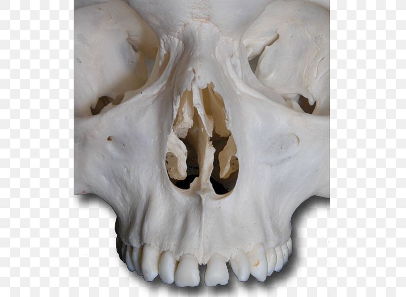 Skull, PNG, 800x600px, Skull, Bone, Jaw Download Free