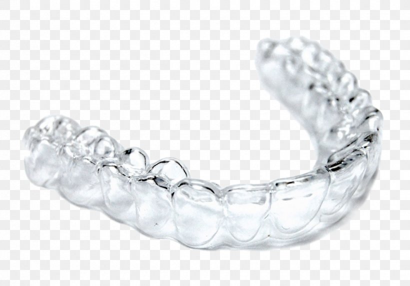 Clear Aligners Dental Braces Orthodontics Dentist Tooth, PNG, 1290x900px, Clear Aligners, Body Jewelry, Bracelet, Chain, Dental Braces Download Free