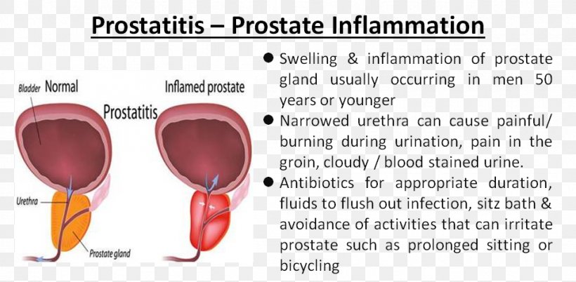 is prostatitis the same as a uti