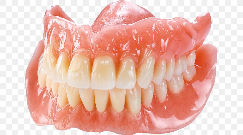 Tooth Dentures Dentistry あさがお歯科高座渋谷, PNG, 649x456px, Tooth, Clinic, Cosmetic Dentistry, Dental Laboratory, Dental Technician Download Free