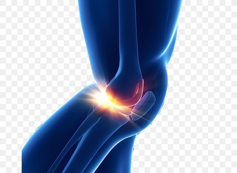 Knee Replacement Medicine Joint Therapy, PNG, 670x600px, Knee, Arm, Close Up, Elbow, Electric Blue Download Free