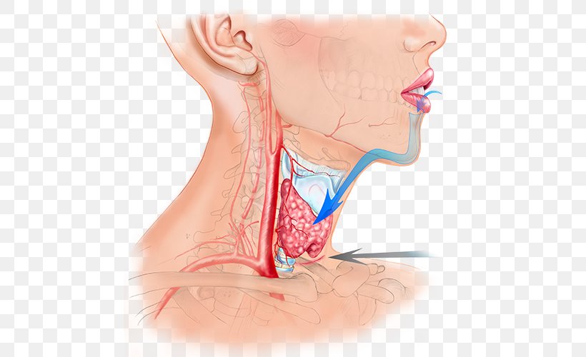 Ear Surgery Thyroidectomy Endoscopy Laparoscopy, PNG, 500x500px, Watercolor, Cartoon, Flower, Frame, Heart Download Free