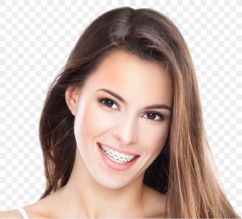 Cosmetic Dentistry Orthodontics Palms Dental Centre, PNG, 2284x2072px, Dentistry, Albert Klitzke Dds, Beauty, Brown Hair, Cheek Download Free