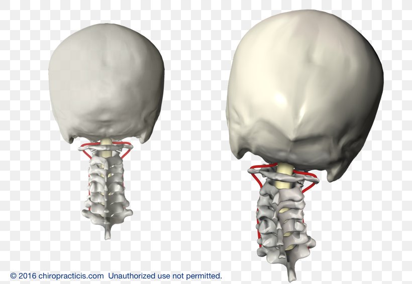 Vertebral Subluxation Vertebral Column Cervical Vertebrae Chiropractic 