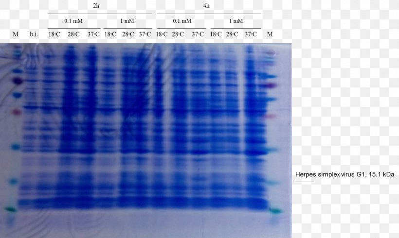 Western Blot Cell SDS-PAGE Staining Polyacrylamide Gel Electrophoresis, PNG, 1561x933px, Western Blot, Blot, Blue, Brand, Cell Download Free