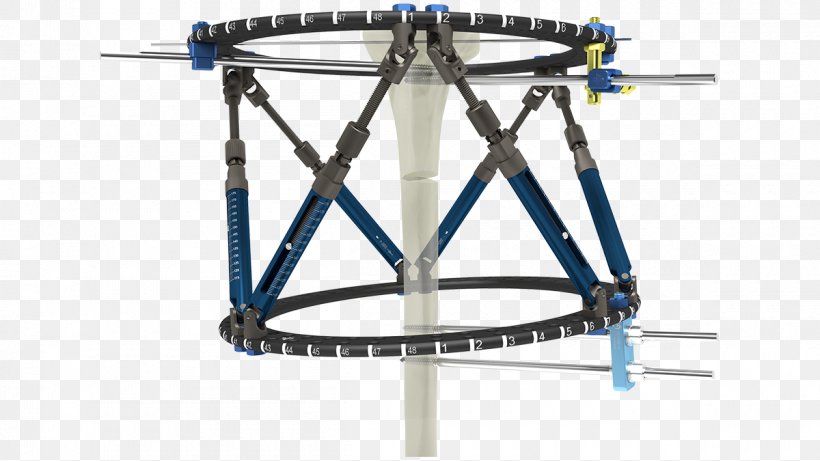 Bicycle Frames Ilizarov Apparatus External Fixation Bicycle Wheels, PNG, 1200x675px, Bicycle Frames, Bicycle, Bicycle Frame, Bicycle Part, Bicycle Wheel Download Free